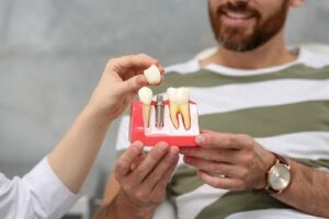 The Dental Implant Process: What Patients Should Know