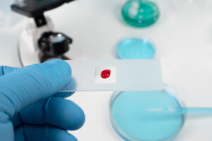4 Ways Wellness Blood Panels Can Detect Hidden Health Issues